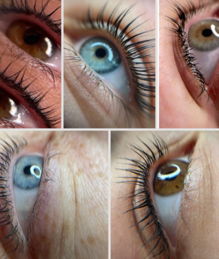 Skropstas un uzacis, Rīga