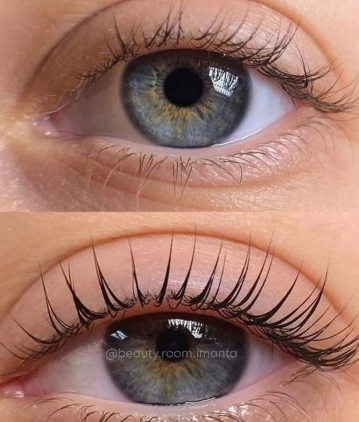 Skropstas un uzacis, Rīga