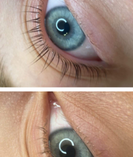 Skropstas un uzacis, Rīga