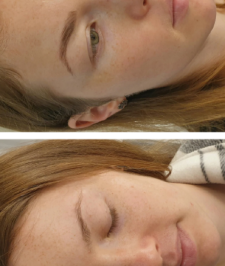 Skropstas un uzacis, Rīga