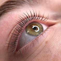 Skropstas un uzacis, Saldus