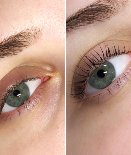 Skropstas un uzacis, Mārupe