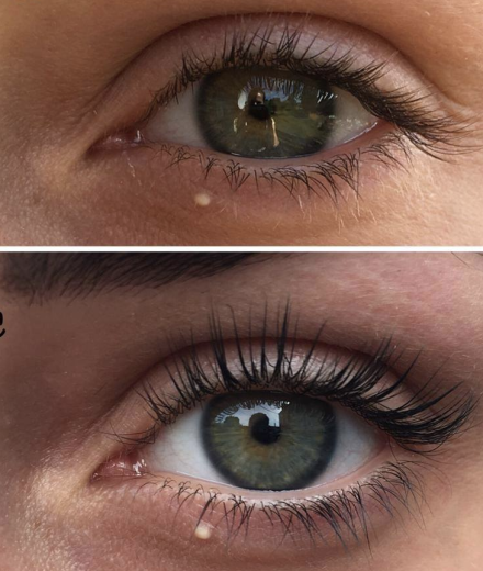 Skropstas un uzacis, Valmiera