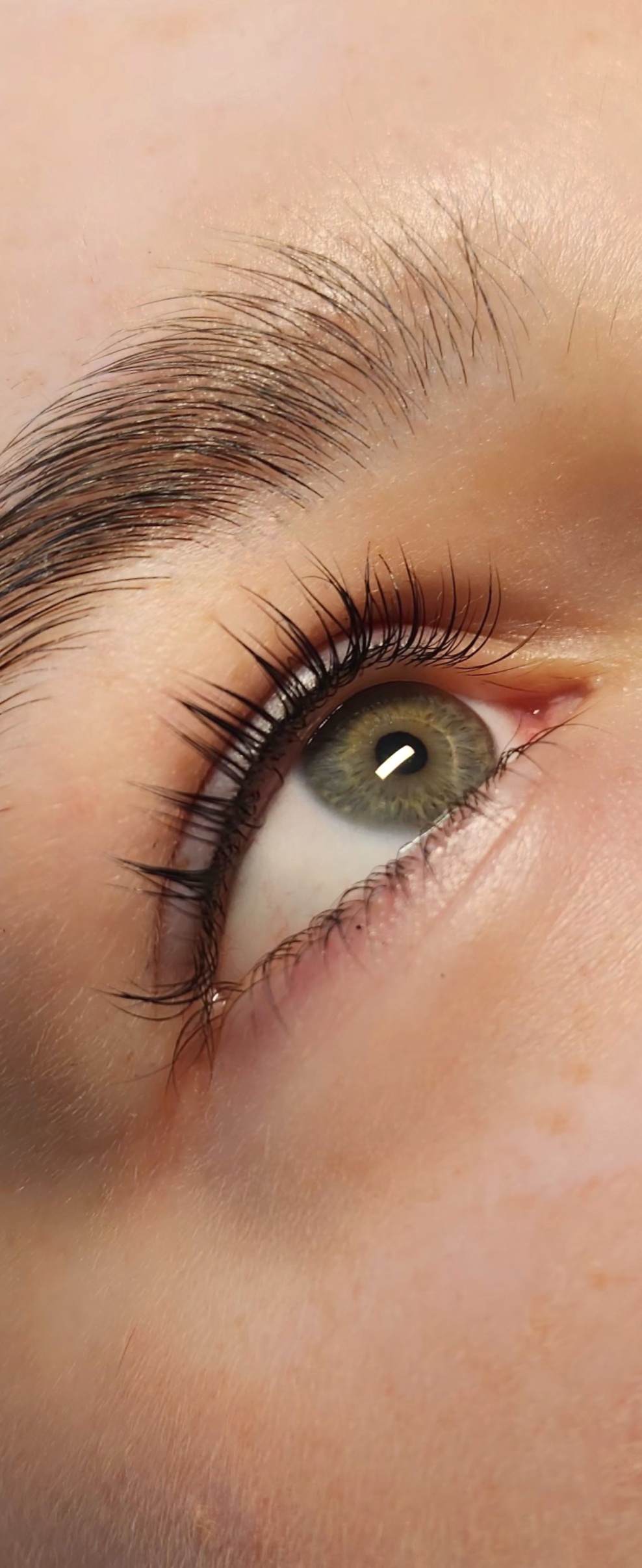 Skropstas un uzacis, 201 A kab