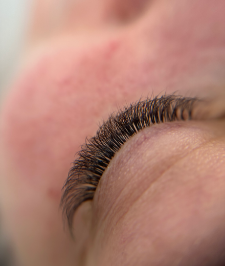 Skropstas un uzacis, Rīga