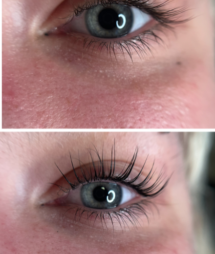 Skropstas un uzacis, Cēsis