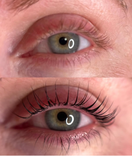 Skropstas un uzacis, Cēsis