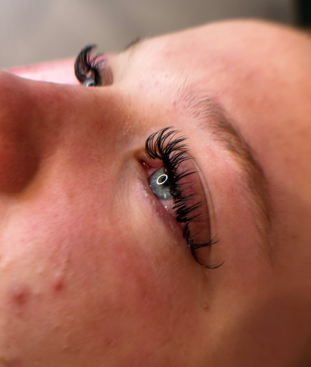 Skropstas un uzacis, Kuldīga